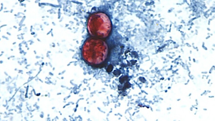 An image taken through a microscope shows two brown circles in the middle surrounded by blue specks