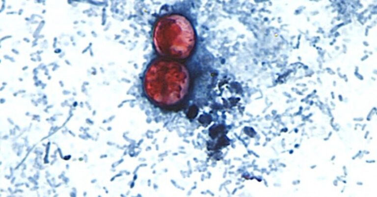 Why avoiding another cyclospora outbreak might take diplomacy Why avoiding another cyclospora outbreak might take diplomacy
