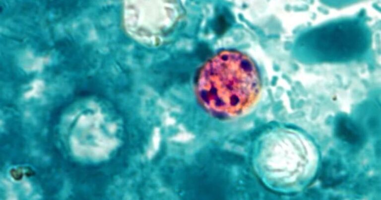 Michigan reports two deaths in ongoing Cyclospora investigation