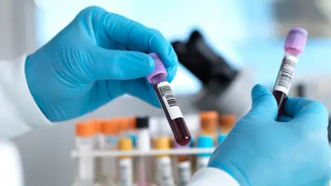 Getty Images Stock photo shows a lab setting with close up of gloved hands holding tubes of blood with bar codes on them, with other tubes in background with bokeh.