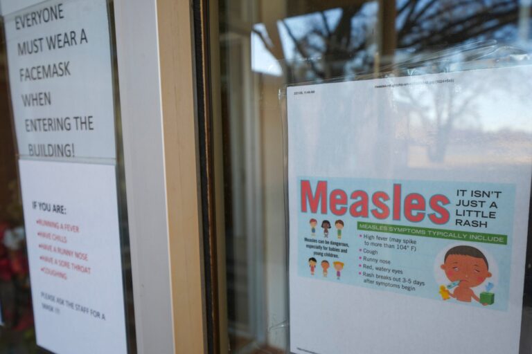 Wisconsin health officials investigating measles outbreak in southwest counties Wisconsin health officials investigating measles outbreak in southwest counties