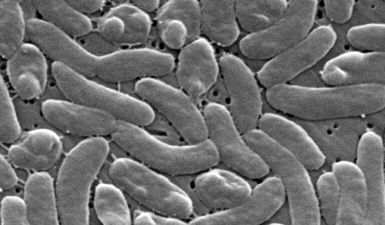 Flesh-eating bacteria kills 5 in Louisiana as cases outpace 10 Flesh-eating bacteria kills 5 in Louisiana as cases outpace 10