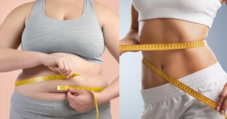 Obesity is not just about weight, cardiovascular risk is more worrying
