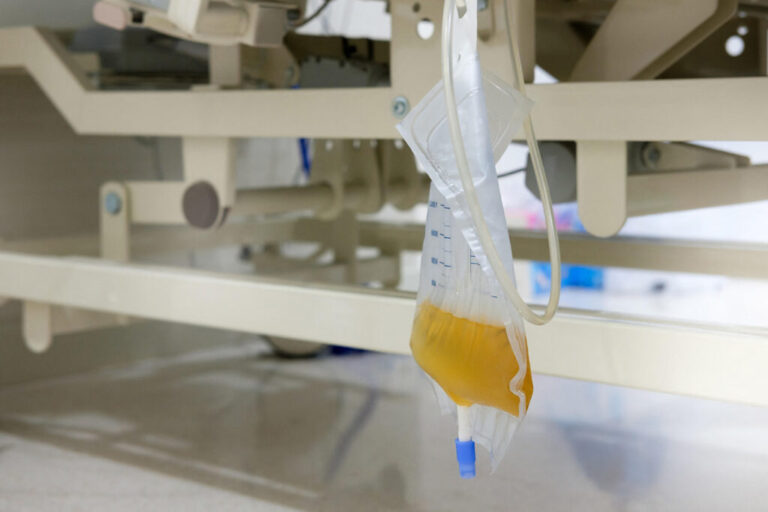 Acute kidney injury: causes, diagnosis and management