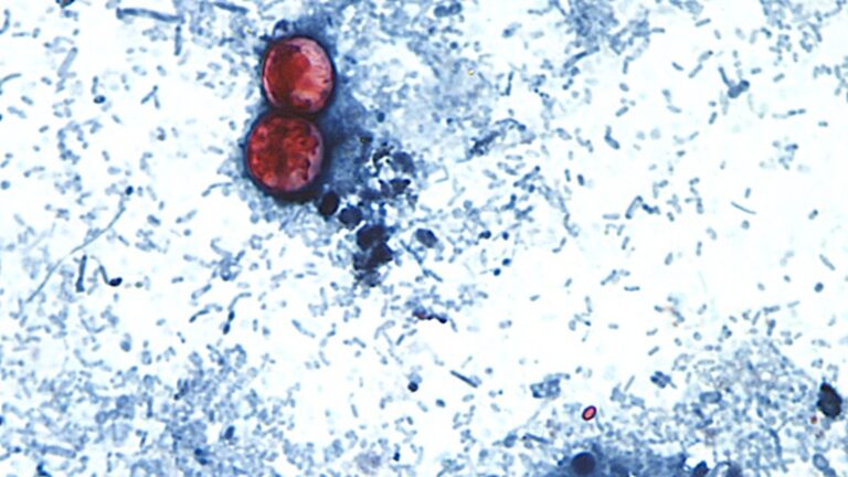 Michigan Reports First 2 US Deaths Related to Cyclospora Outbreak, Hundreds of Cases Reported in Illinois