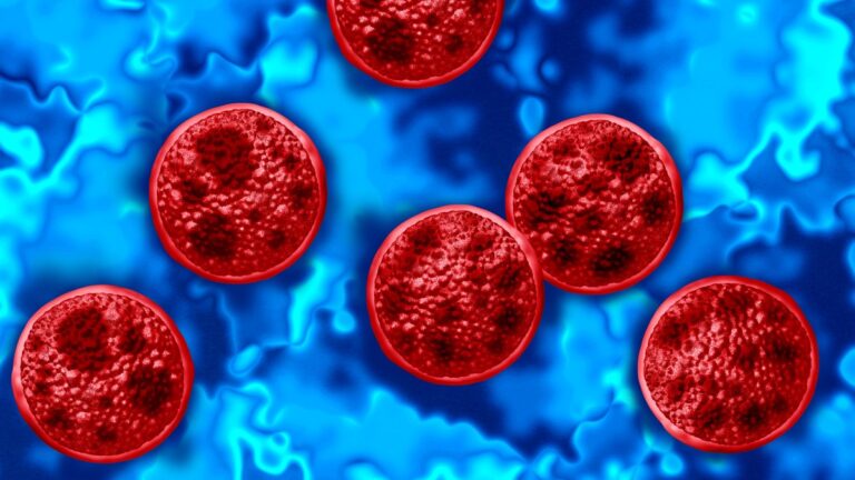 94 cases of cyclosporiasis have now been reported in Connecticut, DPH says 94 cases of cyclosporiasis have now been reported in Connecticut, DPH says