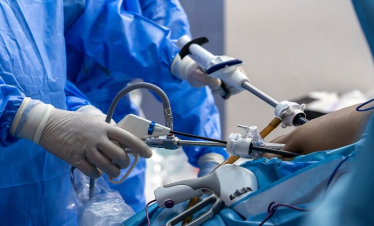 Sleeve Gastrectomy More Effective Than GLP