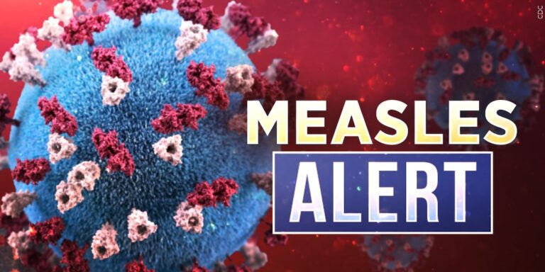 Kentucky health officials warn of potential measles exposures