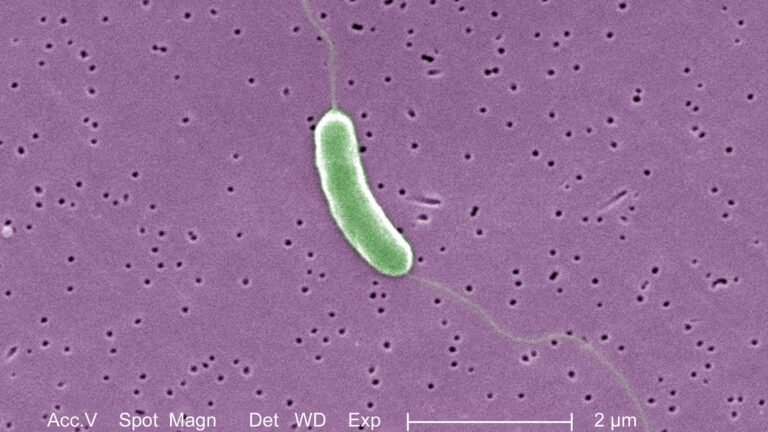 What to Know About the ‘Flesh-Eating’ Bacteria That Killed Someone in Florida
