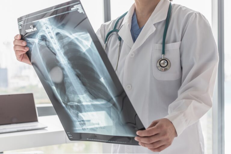 Years After He Quit Smoking, a Lung Cancer Scan Saved His Life Years After He Quit Smoking, a Lung Cancer Scan Saved His Life
