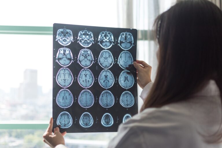 Researchers uncover new lifestyle factor that could affect Alzheimer’s risk Researchers uncover new lifestyle factor that could affect Alzheimer's risk