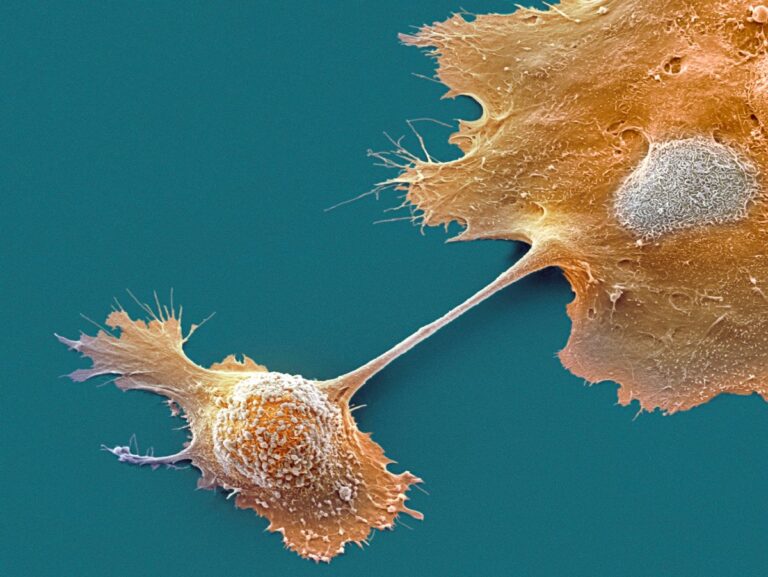 U.S. approves breakthrough pancreatic cancer drug, heralding a new era for an intractable disease U.S. approves breakthrough pancreatic cancer drug, heralding a new era for an intractable disease