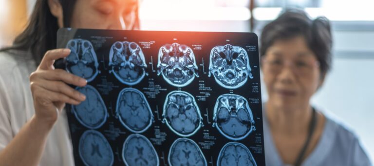 Researchers work to address Alzheimer’s and dementia in rural communities Researchers work to address Alzheimer’s and dementia in rural communities