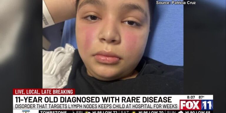 Tucson boy diagnosed with rare disease
