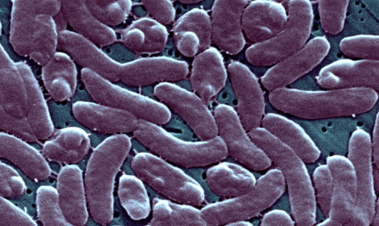 Flesh-eating bacteria kills 5 in Louisiana: What is Vibrio vulnificus? What are the symptoms? Flesh-eating bacteria kills 5 in Louisiana: What is Vibrio vulnificus? What are the symptoms?