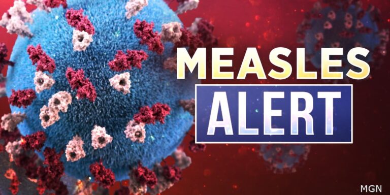Measles case confirmed in Tioga County; contact tracing underway Measles case confirmed in Tioga County; contact tracing underway