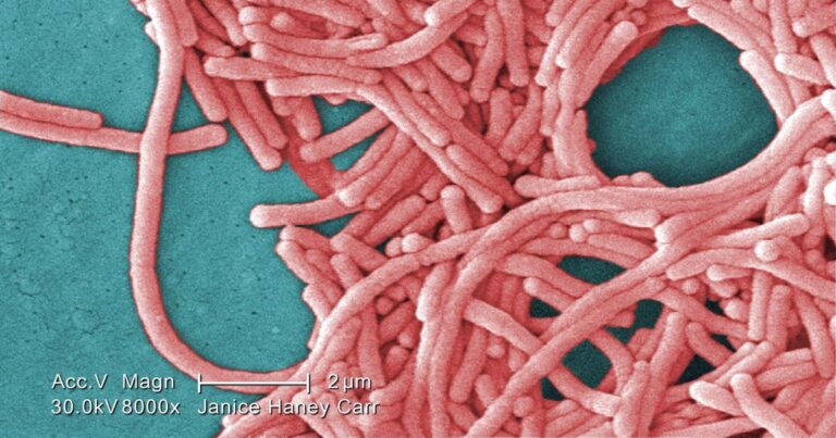 Legionnaires’ disease outbreak near downtown Toronto under investigation Legionnaires’ disease outbreak near downtown Toronto under investigation