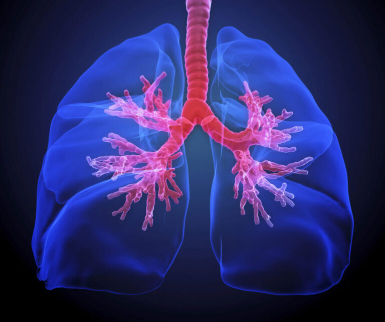 Steroid Curbs Chronic Lung Inflammation Without Weakening Immune Defenses