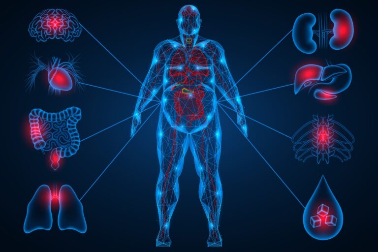Organ dysfunction assessment in obesity could improve bariatric surgery prioritisation, study suggests