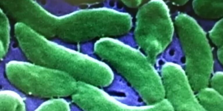 5 dead, 9 hospitalized in La. vibrio bacteria outbreak 5 dead, 9 hospitalized in La. vibrio bacteria outbreak