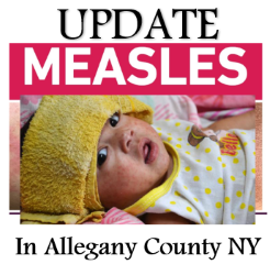 Update: Allegany County Health Department Confirms Additional Measles Case Linked to Initial Investigation Update: Allegany County Health Department Confirms Additional Measles Case Linked to Initial Investigation