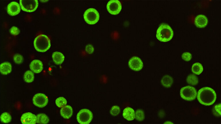 Cold Spring Harbor Laboratory and Northwell Health lead international cohort of researchers to develop more than 150 next-generation cancer treatment models Cold Spring Harbor Laboratory and Northwell Health lead international cohort of researchers to develop more than 150 next-generation cancer treatment models