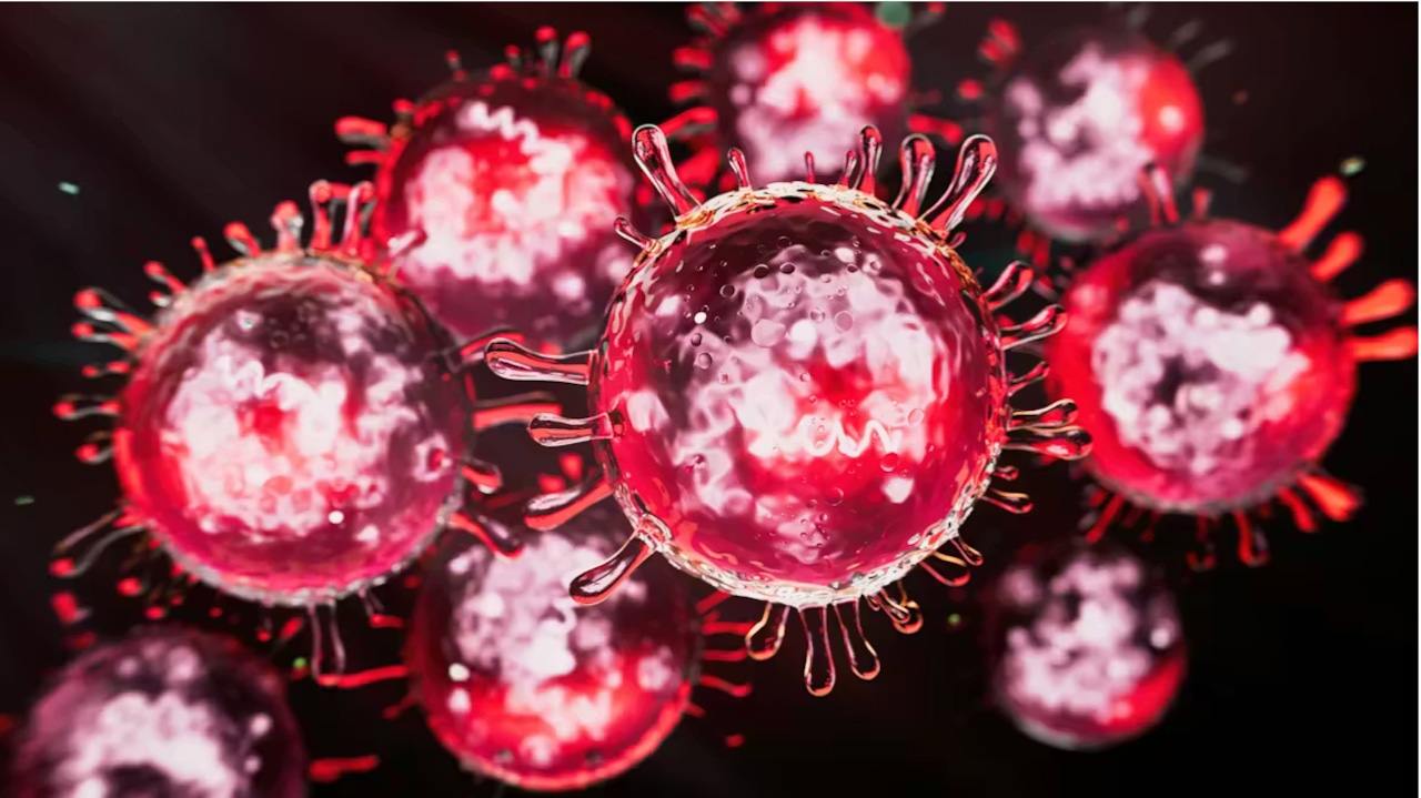 Measles