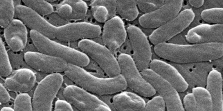 5 dead, 4 hospitalized from flesh-eating bacteria outbreak, health officials say 5 dead, 4 hospitalized from flesh-eating bacteria outbreak, health officials say