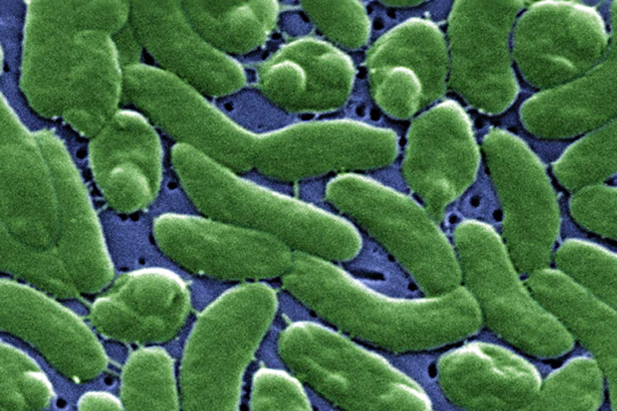 False color scanning electron micrograph of Vibrio vulnificus bacteria. Credit: CDC/James Gathany