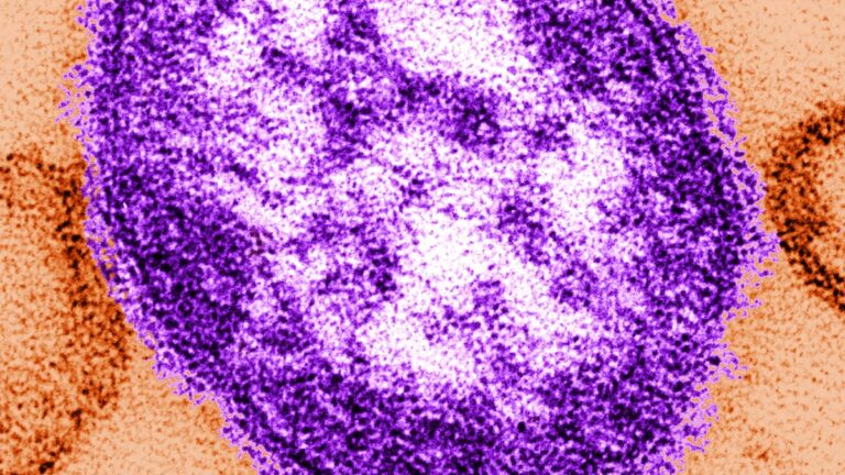 Oregon health officials warn of possible measles exposure at crowded Canby Rodeo