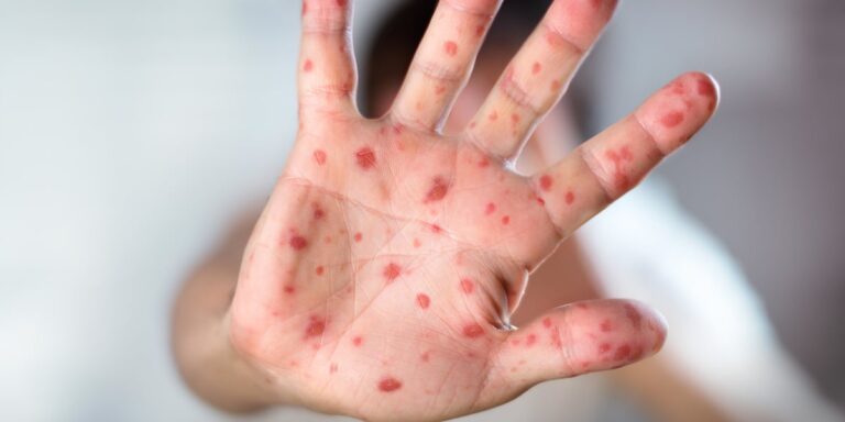 Kansas City Health Department debuts public disease Kansas City Health Department debuts public disease