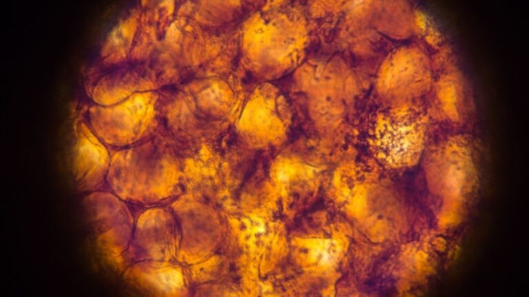 Our Fat Tissue May 'Remember' Obesity, Even After We've Lost Weight