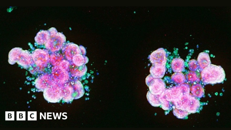 Plans for £20m hub in Cambridge to develop new medicines using AI
