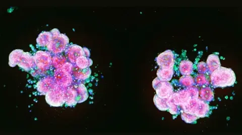 Cambridge Stem Cell Institute Microscopic image showing two clusters of pink and purple lab-grown cells, known as organoids, surrounded by smaller blue and green cells against a black background.