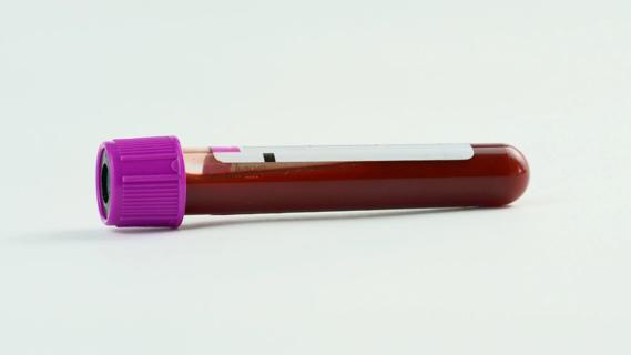 Photo of blood in a test tube.