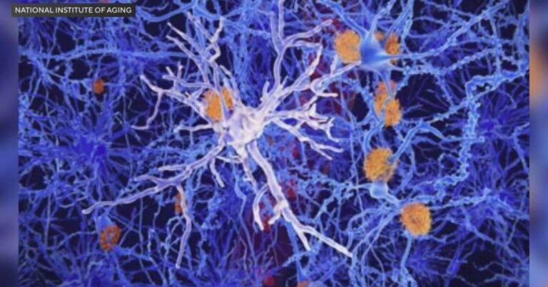 Expert emphasizes how metabolism and lifestyle choices today can predict brain health in older age