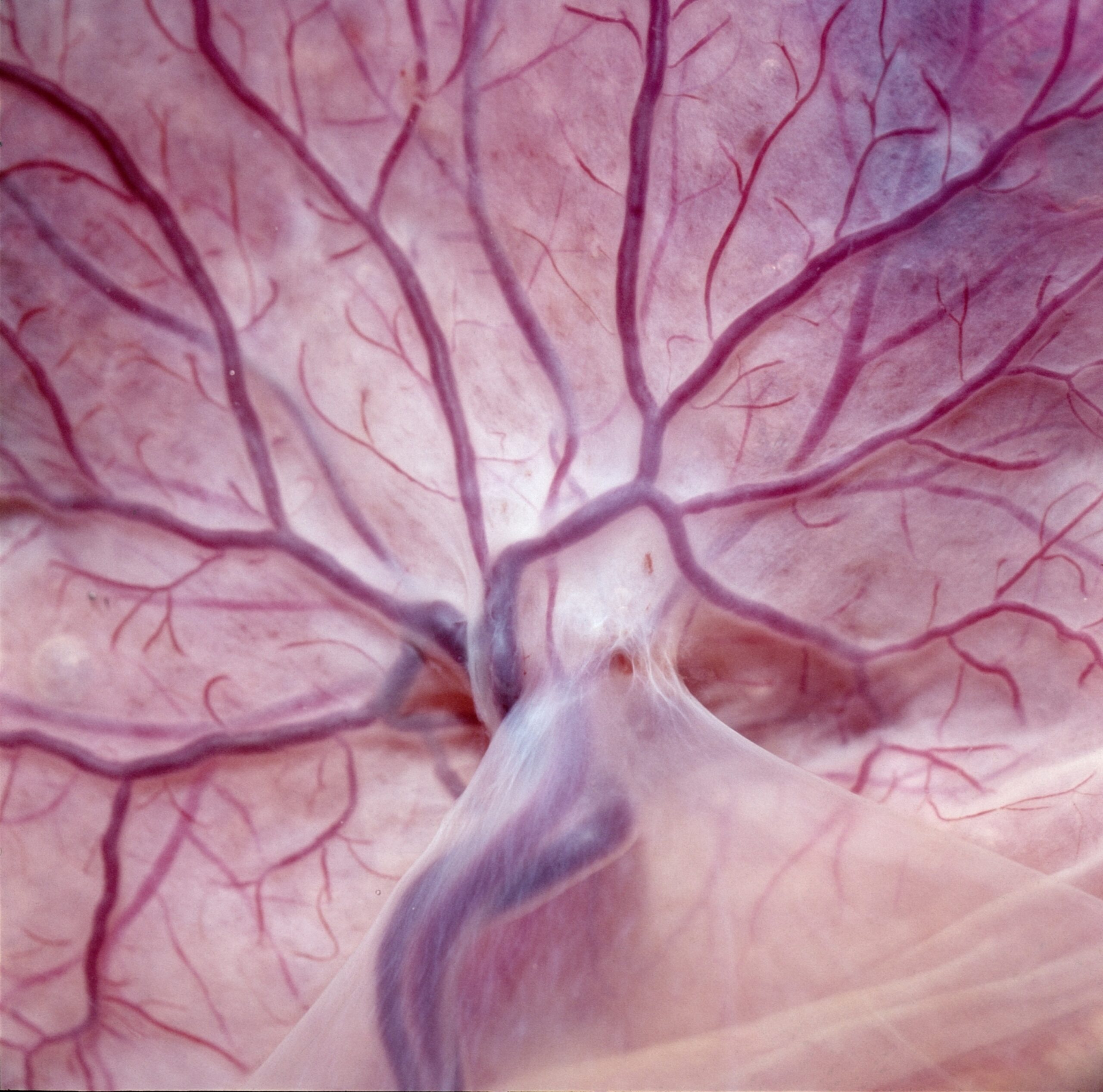 A close-up view of the human placenta showing a complex network of dark purple blood vessels branching out across the pale, translucent tissue.
