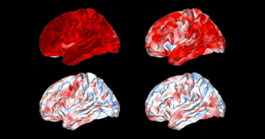 Neuropsychiatric MRI brain signatures fail reproducibility test Neuropsychiatric MRI brain signatures fail reproducibility test