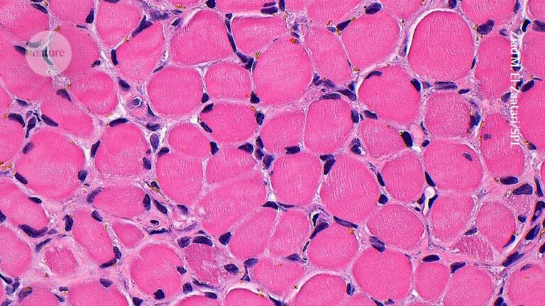 This pulsating muscle graft mimics benefits of exercise