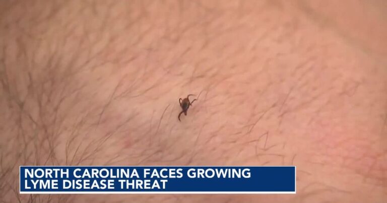 Ticks carrying Lyme disease are gaining ground in North Carolina, study finds Ticks carrying Lyme disease are gaining ground in North Carolina, study finds