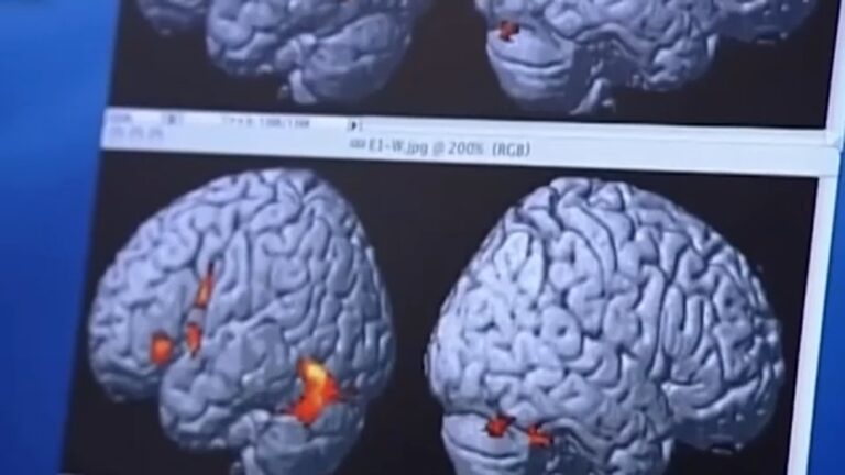 Healthy midlife habits could delay dementia by up to 13 years, study finds Healthy midlife habits could delay dementia by up to 13 years, study finds