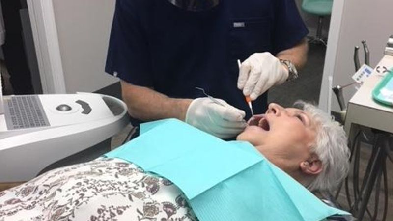 Dr. Douglas Sheets works on cleaning teeth of a patient at his Federal Way dentistry. (KOMO Photo)