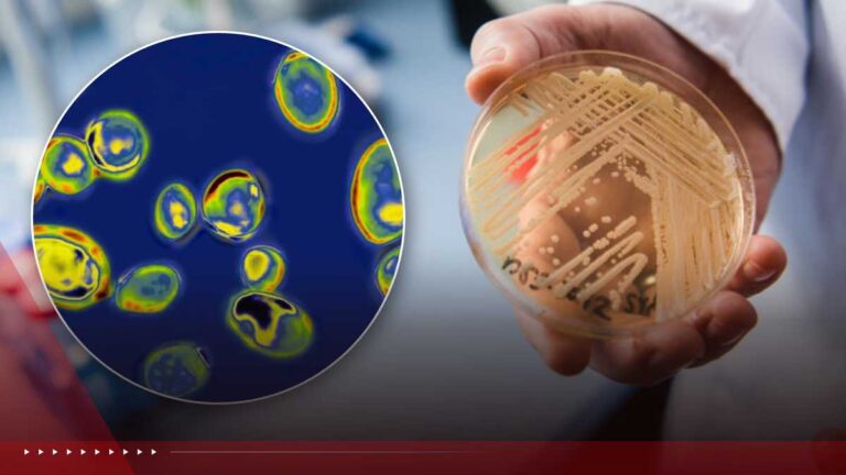 Drug-resistant ‘superbug’ fungus spreads to 23 states. What you should know Drug-resistant ‘superbug’ fungus spreads to 23 states. What you should know