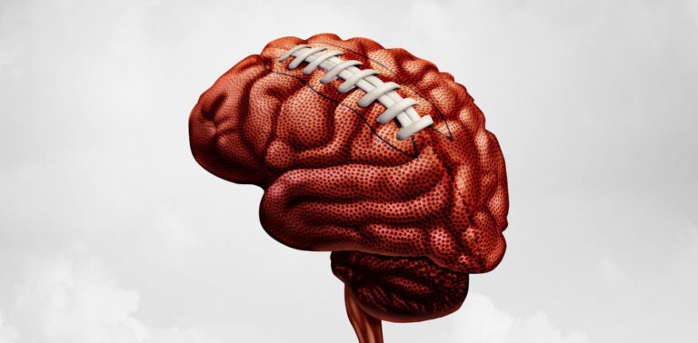 Sports leagues’ concussion guidelines must be broadened as brain health concerns rise
