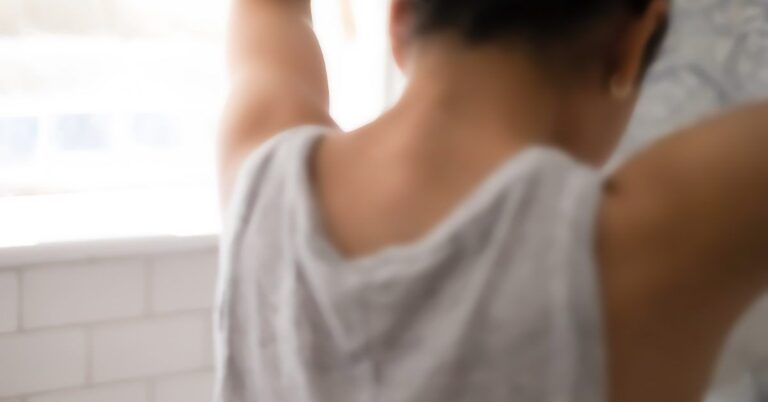 Alopecia areata: Rheumatoid arthritis drug may treat hair loss Alopecia areata: Rheumatoid arthritis drug may treat hair loss