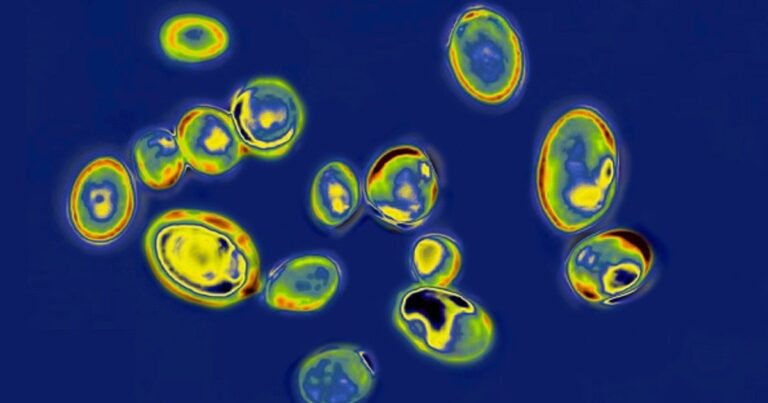 CDC: 13 cases in 2026 of new fungus in WA CDC: 13 cases in 2026 of new fungus in WA