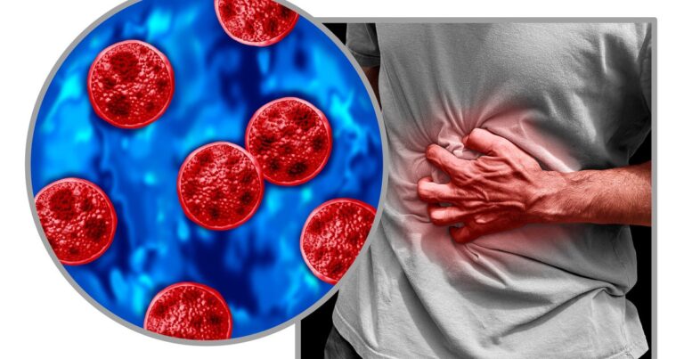 Michigan health officials report 2 deaths among cyclosporiasis cases; patients had underlying conditions Michigan health officials report 2 deaths among cyclosporiasis cases; patients had underlying conditions