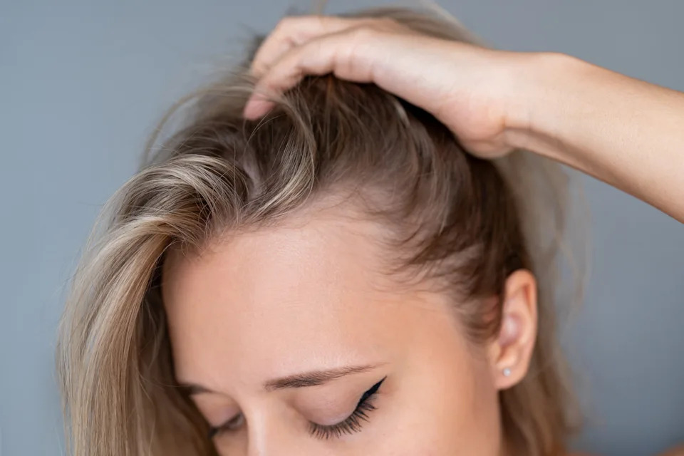 Person touching their scalp with eyebrow and eyeliner visible; focus on hair and scalp health