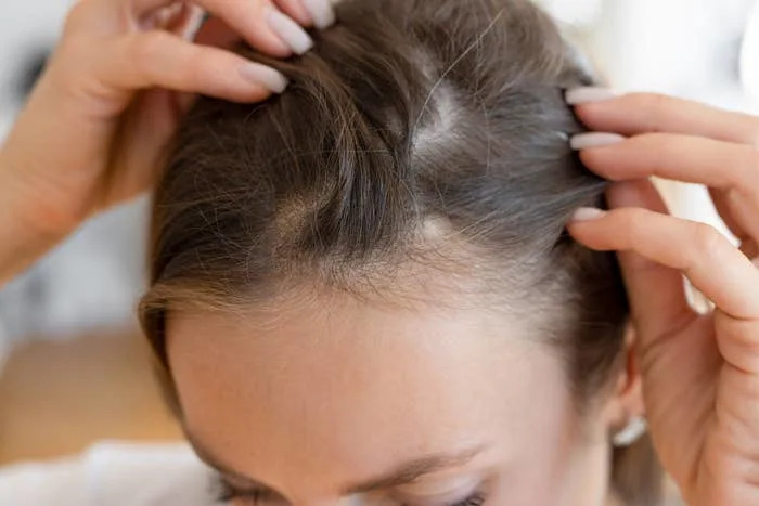 Person examining their scalp, focusing on hair and part line, indicating concern about hair health or potential hair thinning issues