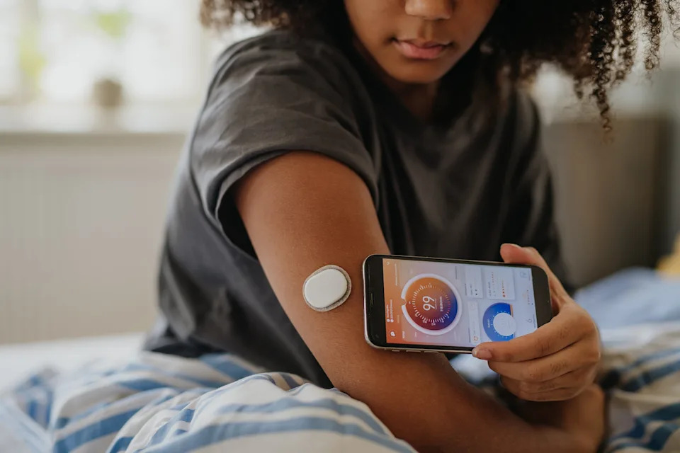 Person using a smartphone to monitor a glucose sensor on their arm, showing a health app interface